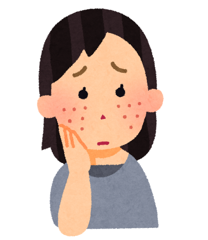 よく効くニキビ治療薬は?実際に使ってみた感想をご紹介